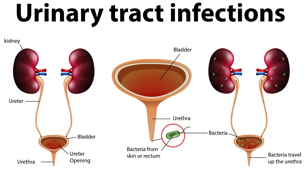 Diagram of the Urinary Tract